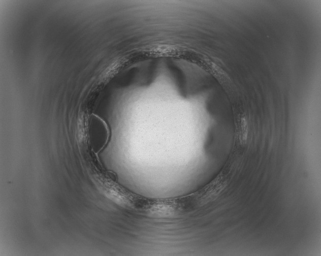 X0000079300236200612011758