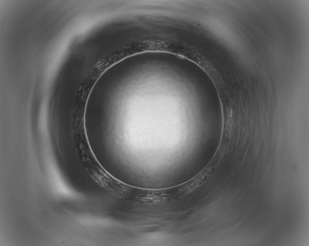X0000079300383200612011756