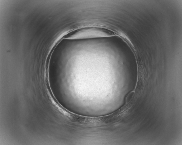 X0000079301095200612011743