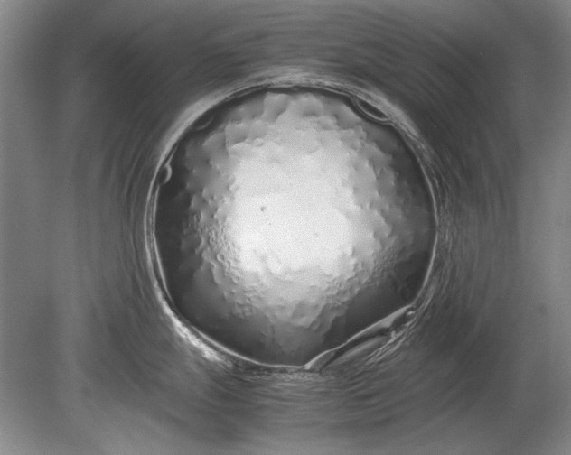 X0000079301247200612011741