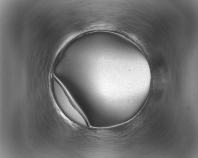 X0000079301383200612011738