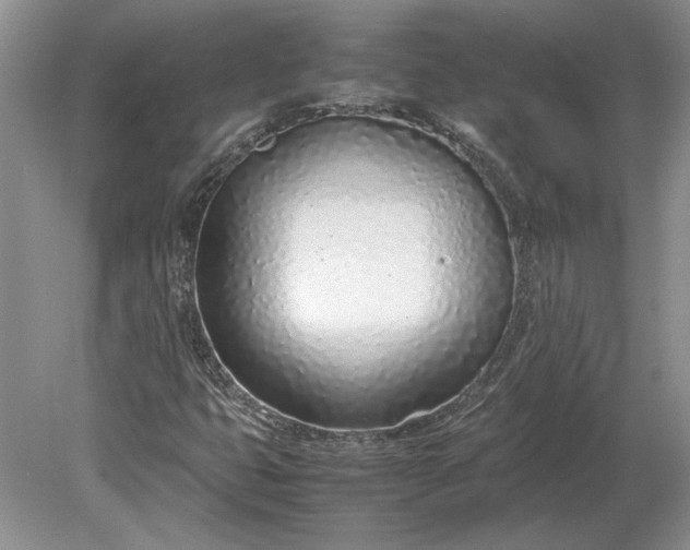X0000079301399200612011738