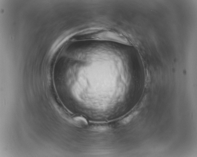 X0000079300247200612081851