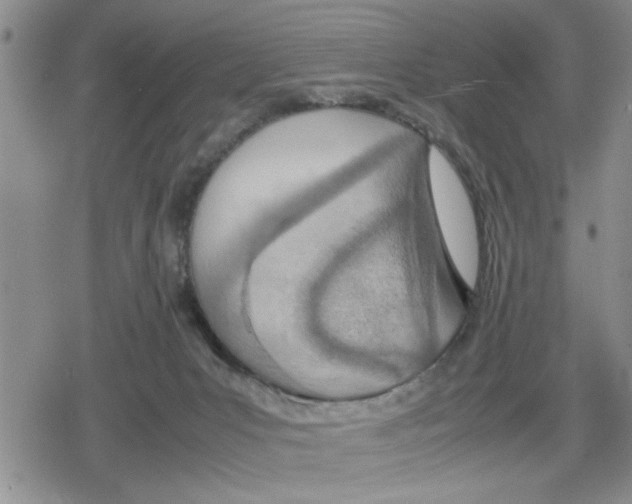 X0000079300031200612151738