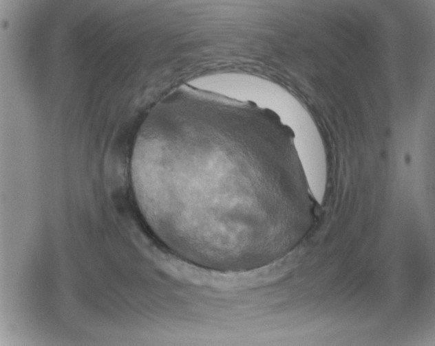 X0000079300039200612151738