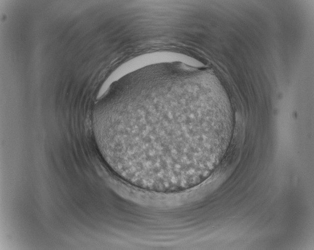 X0000079300048200612151738