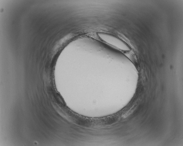 X0000079300203200612151735