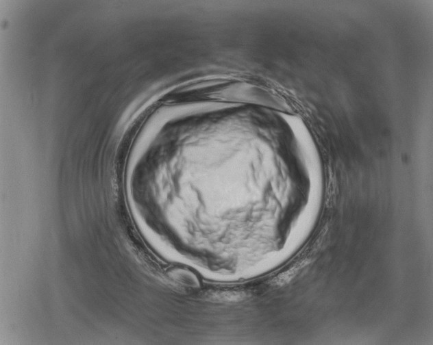 X0000079300247200612151734