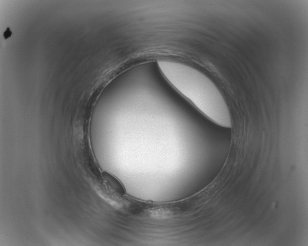X0000079310500200611170858