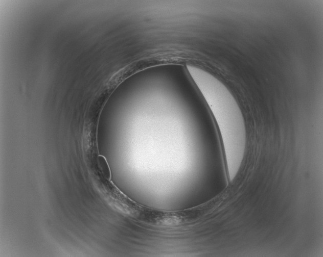 X0000079310600200611170857