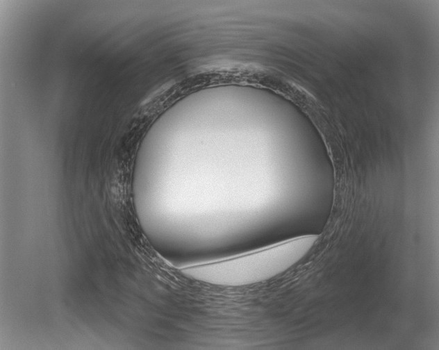 X0000079310869200611170852