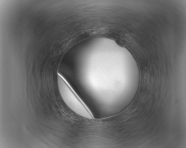 X0000079311250200611170846