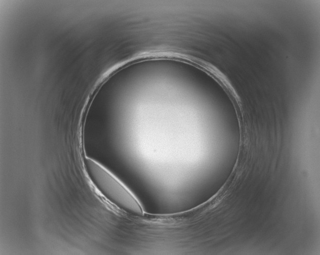 X0000079311388200611170843