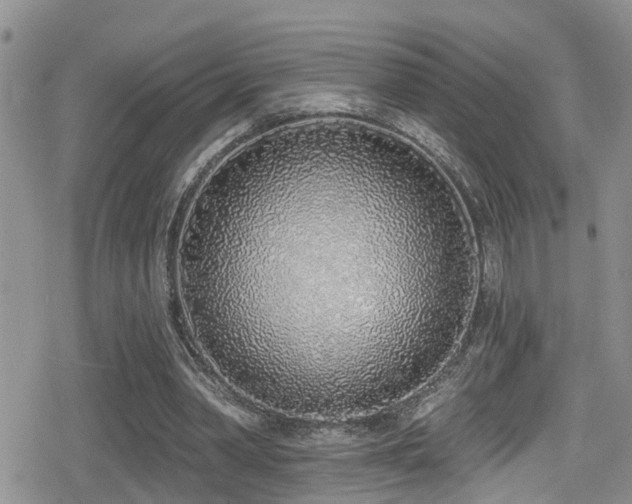 X0000079310390200611171101