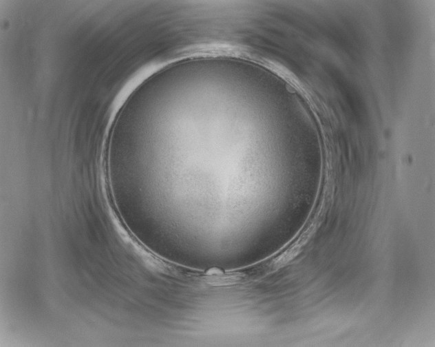 X0000079311440200611171044