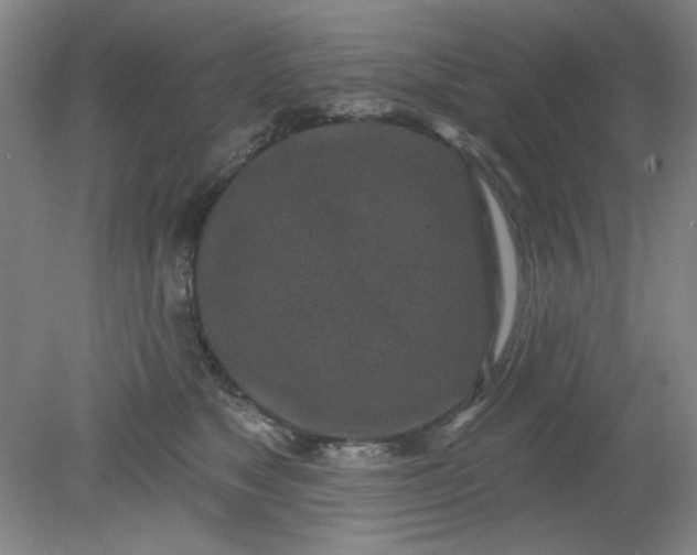 X0000079310517200612011819