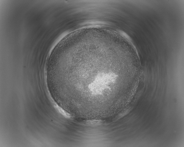 X0000079310859200612011814