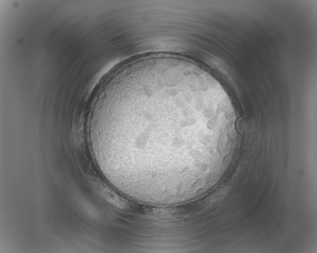 X0000079310875200612011813