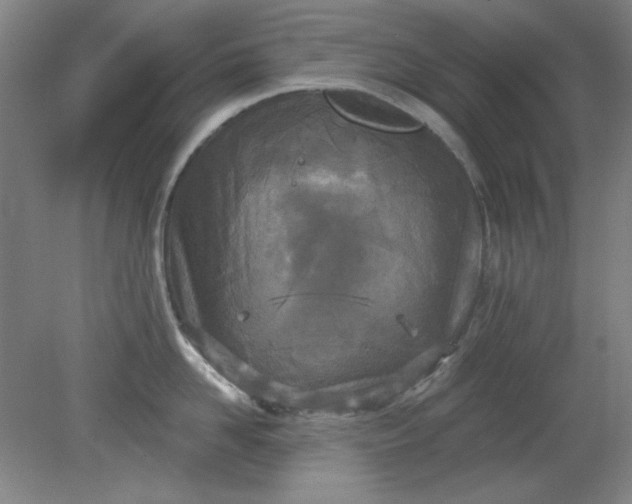 X0000079310958200612011813