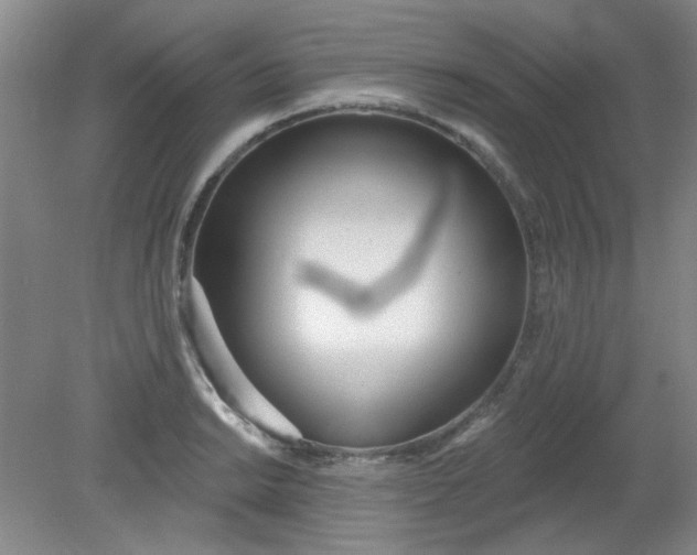 X0000079311038200612011811