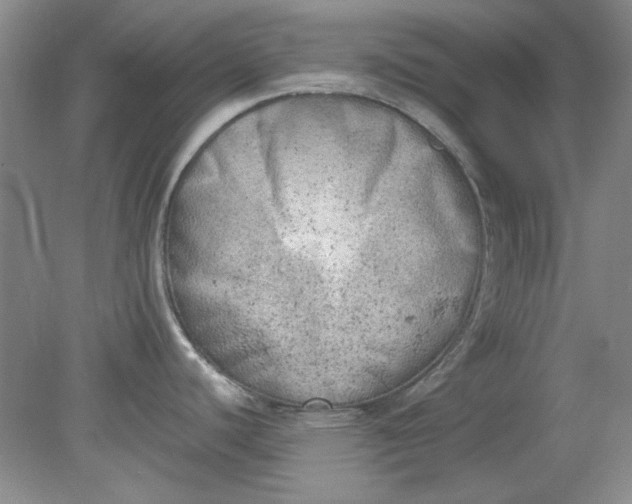 X0000079311440200612011805