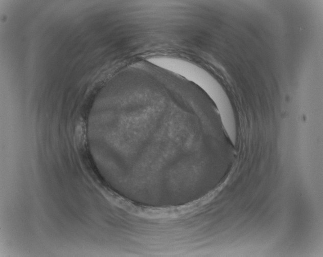 X0000079310029200612151803