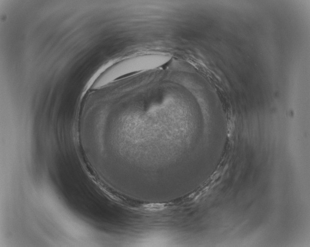 X0000079310052200612151802