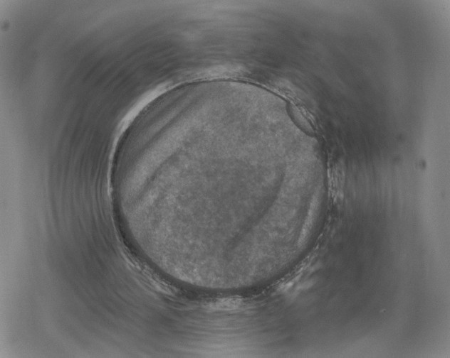 X0000079310196200612151800