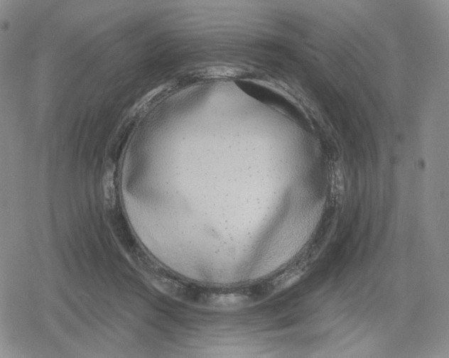 X0000079310360200612151758