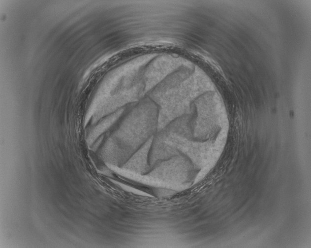 X0000079310920200612151748