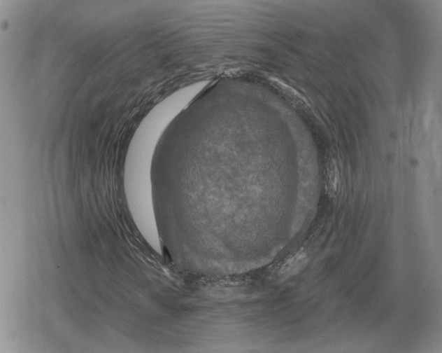 X0000079311010200612151747