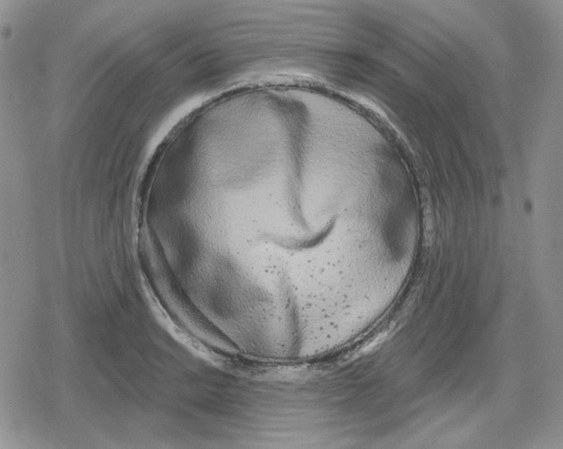 X0000079311038200612151747