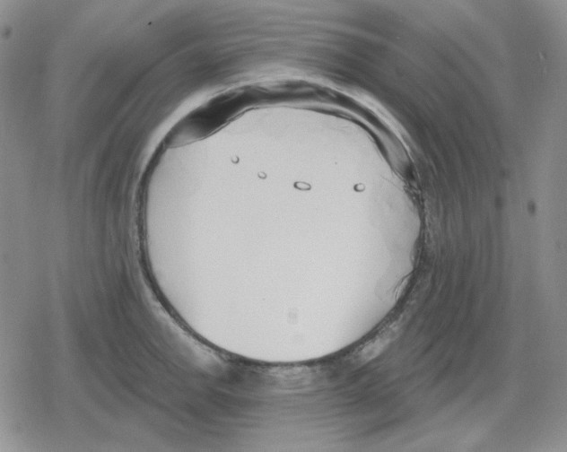 X0000079311142200612151746