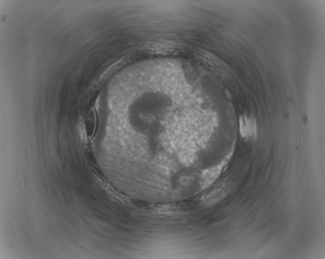 X0000079311155200612151745