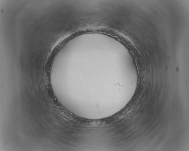 X0000079311160200612151745