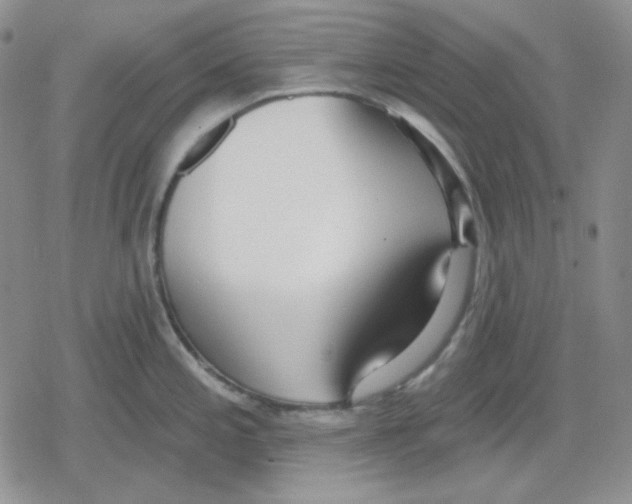 X0000079311197200612151744