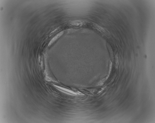 X0000079311394200612151740