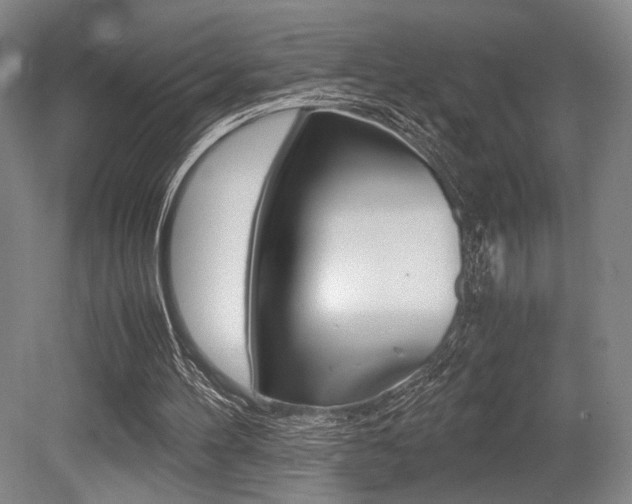 X0000079320100200611170941