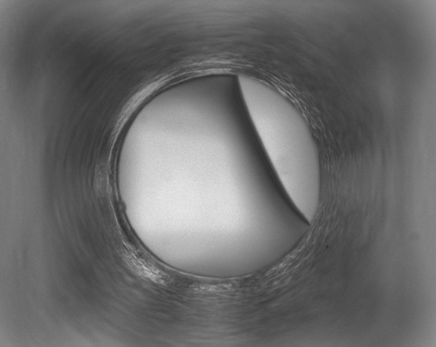 X0000079320147200611170939