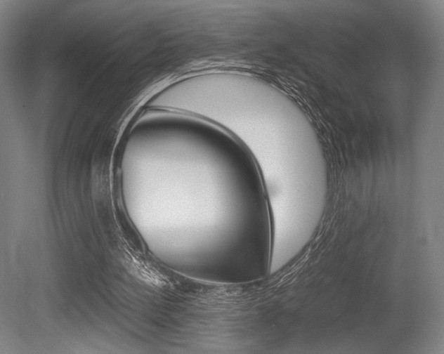 X0000079320148200611170939