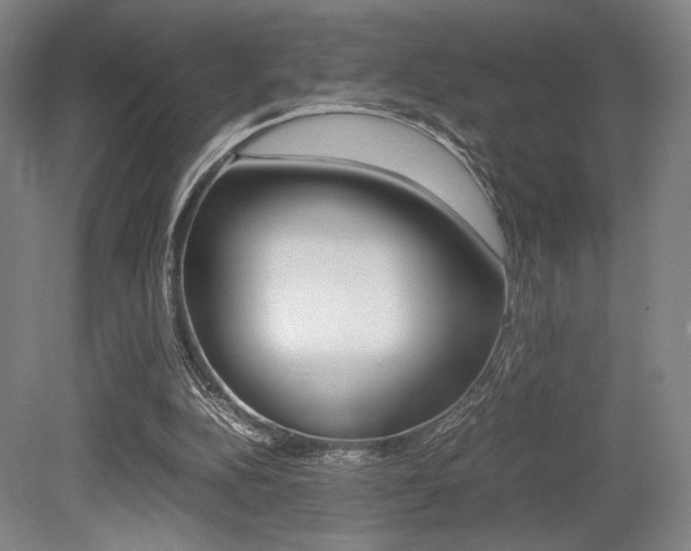 X0000079320152200611170939