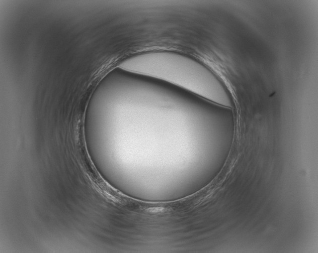 X0000079320153200611170939