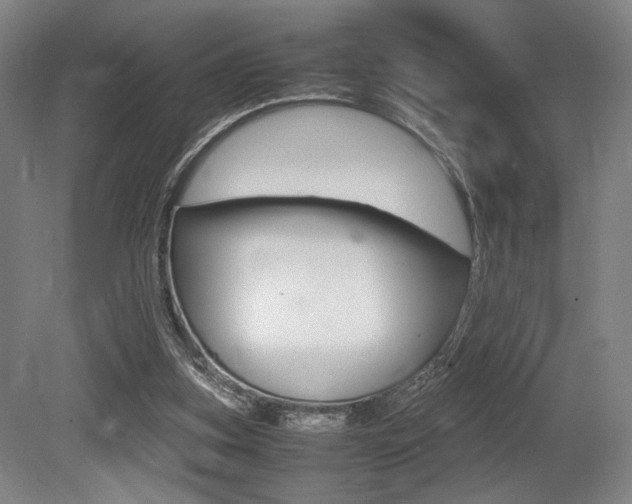 X0000079320155200611170939