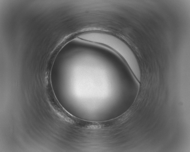 X0000079320160200611170939