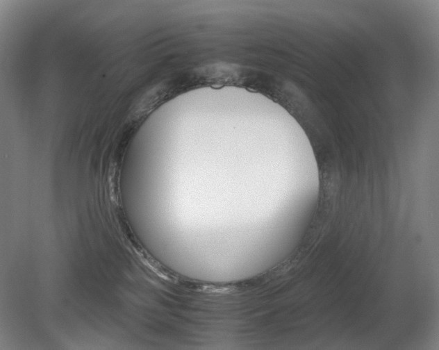 X0000079320185200611170940