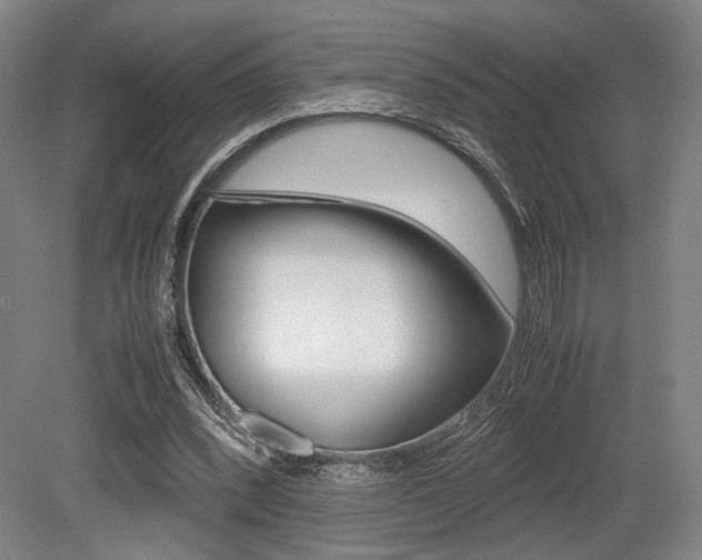 X0000079320392200611170936