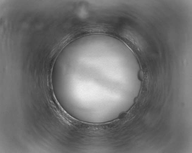 X0000079320729200611170930