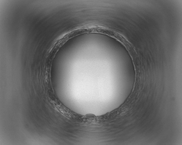 X0000079321016200611170925