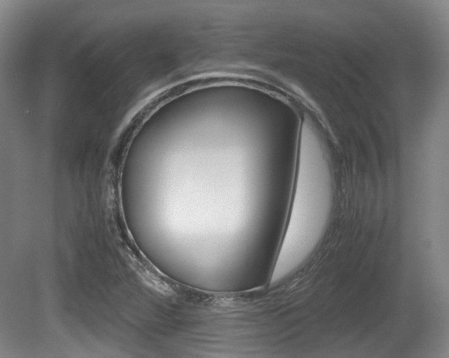 X0000079321360200611170920