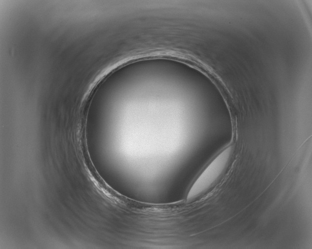 X0000079321500200611170917